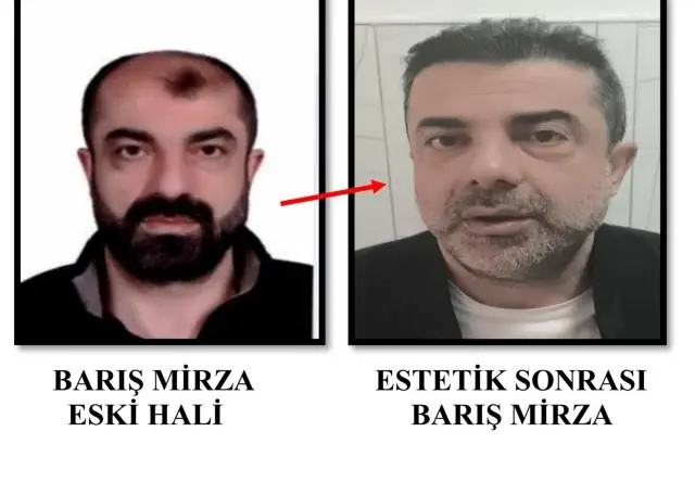 Cinayet zanlısı estetikle bambaşka biri oldu! Türkiye’ye adım atar atmaz yakalandı